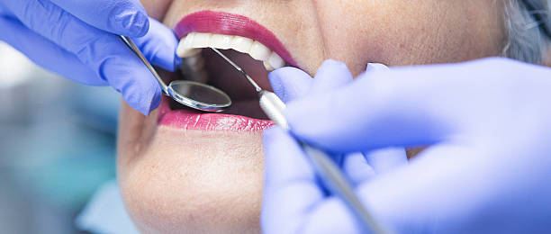 Best Walk-In Dentist Near Me  in Ives Estates, FL